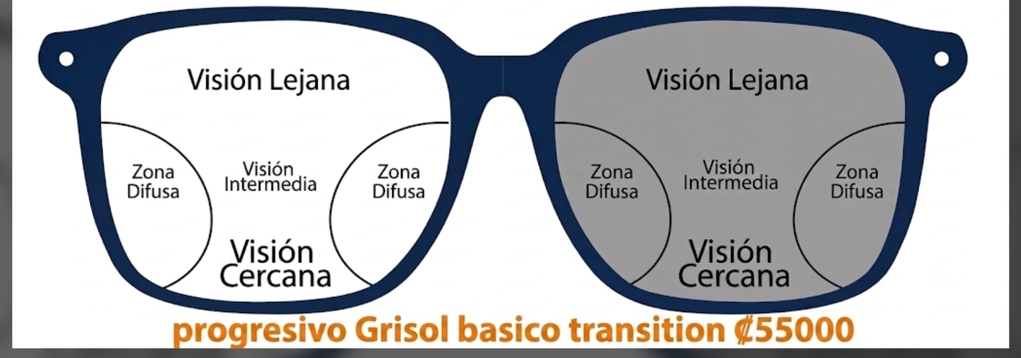 progresivos transition Basico